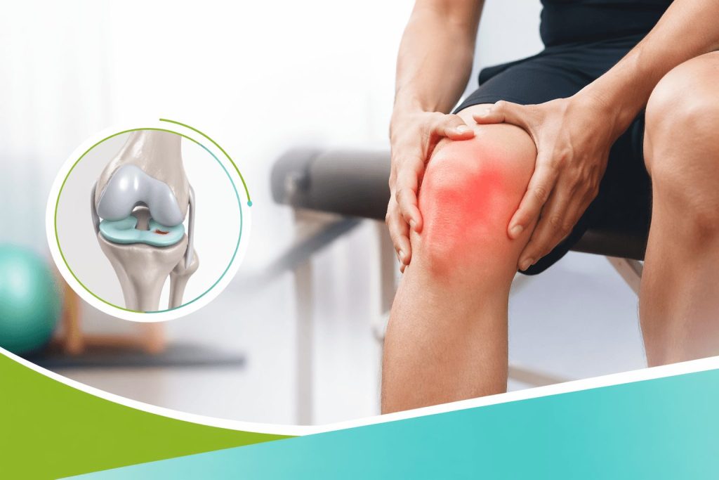 Anatomical illustration of a torn meniscus with a person holding their knee in discomfort, symbolizing knee pain and advanced nonsurgical solutions.