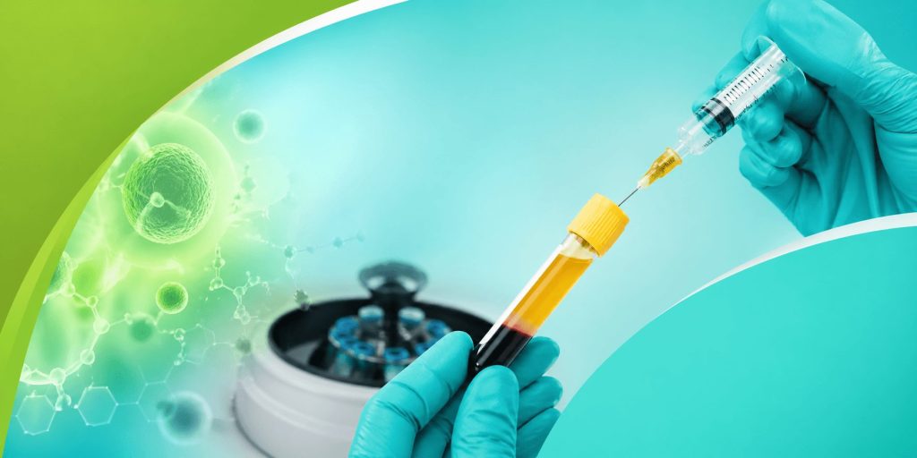 Platelet-rich plasma (PRP) therapy preparation with syringe and blood sample in a modern medical setting, representing regenerative healing treatment